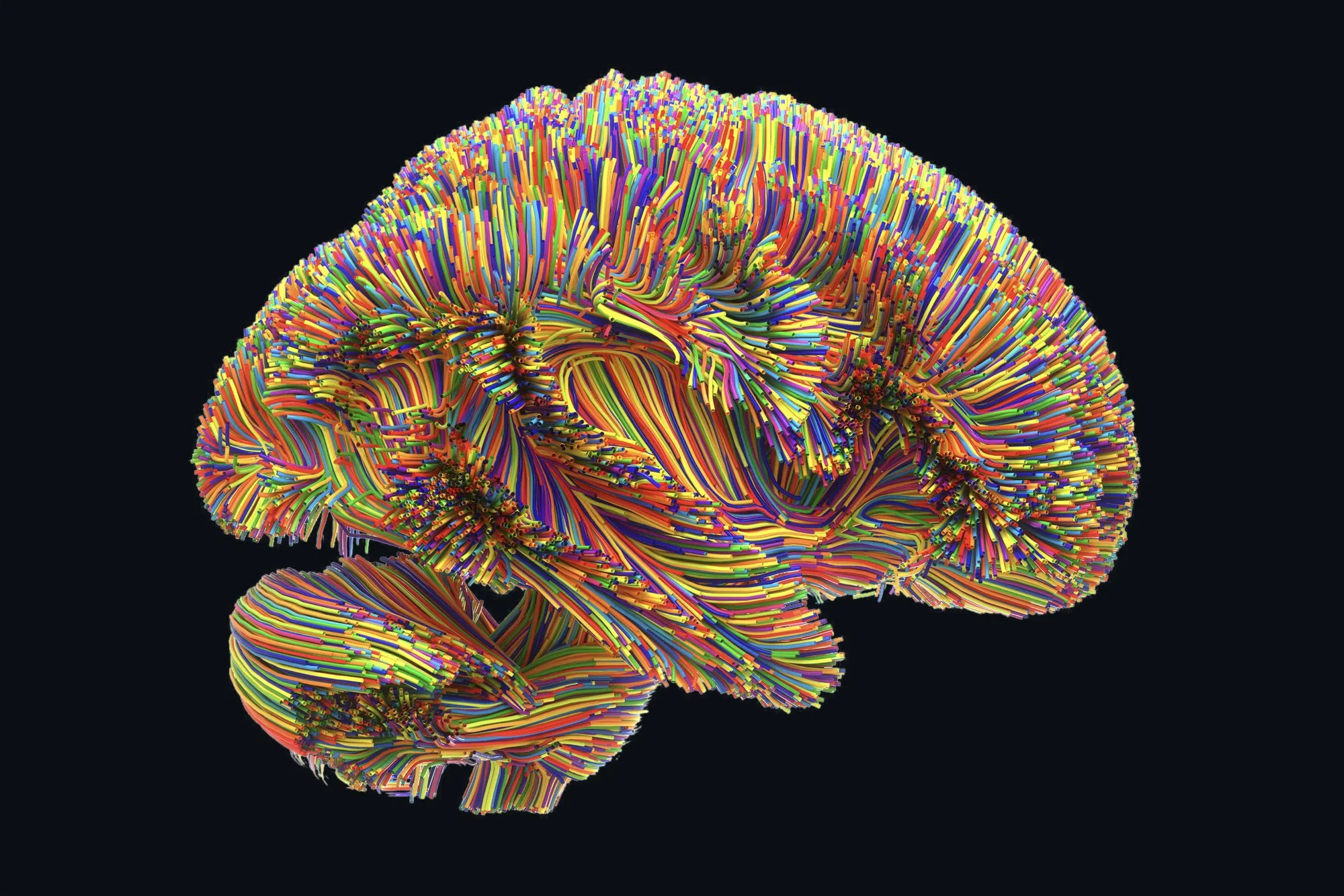 Cerebro formado por miles de fibras de colores